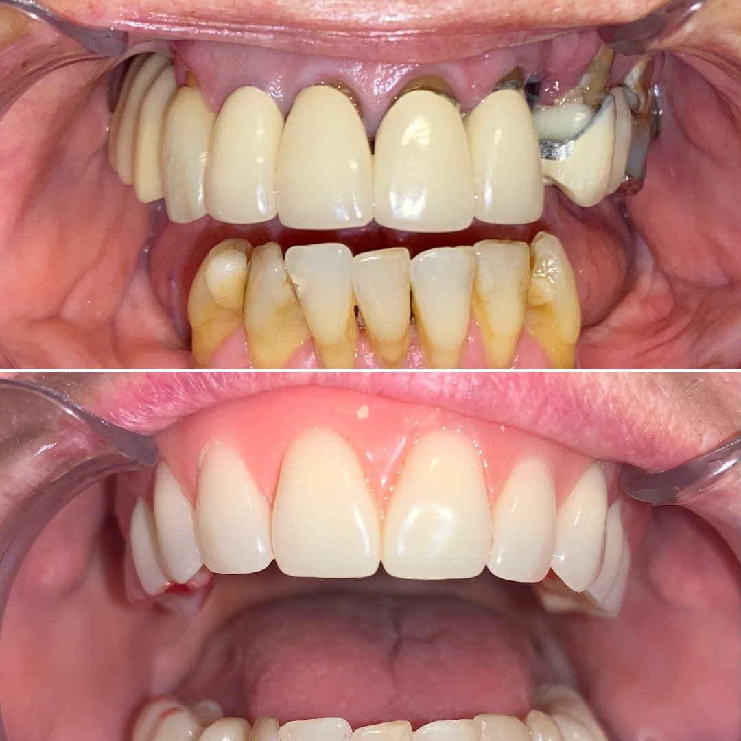 antes-depois2