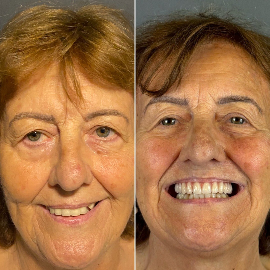 antes-depois4
